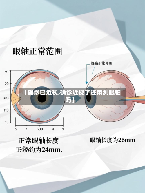 【确诊已近视,确诊近视了还用测眼轴吗】-第2张图片