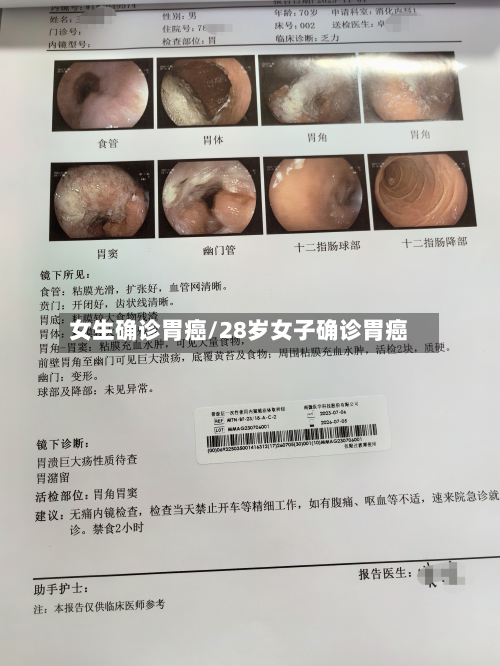 女生确诊胃癌/28岁女子确诊胃癌-第2张图片