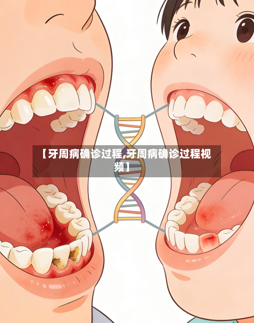 【牙周病确诊过程,牙周病确诊过程视频】-第2张图片