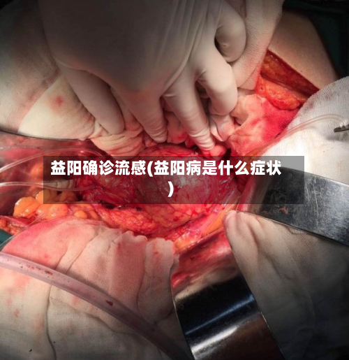 益阳确诊流感(益阳病是什么症状)
