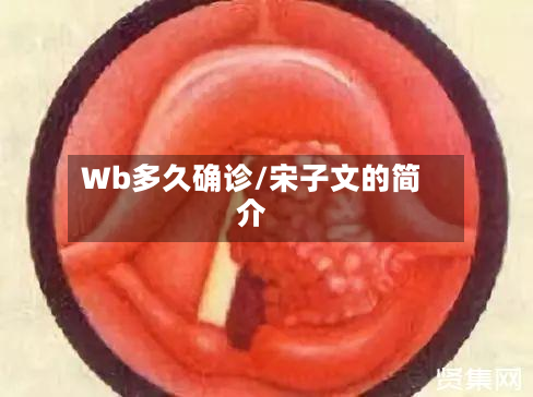 Wb多久确诊/宋子文的简介