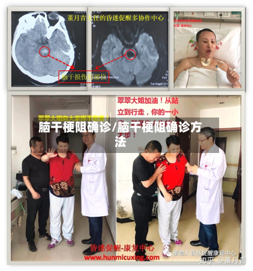 脑干梗阻确诊/脑干梗阻确诊方法