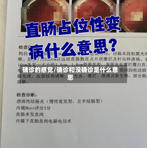 确诊的感觉/确诊和没确诊是什么意思-第3张图片