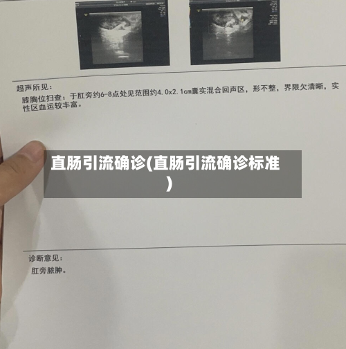 直肠引流确诊(直肠引流确诊标准)-第2张图片