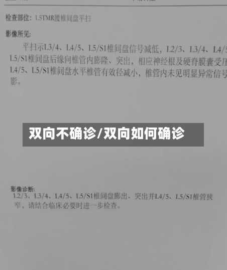 双向不确诊/双向如何确诊-第2张图片